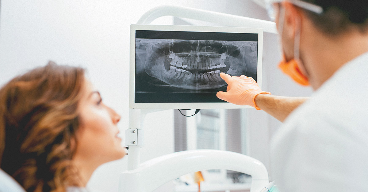 Dental X-Ray Market